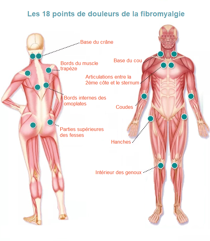 Institut-pour-l-ergodynamie-maladie-autoimmune-fibromyalgie